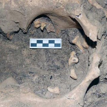 Unearthing an Ancient Medical Anomaly at Amarna