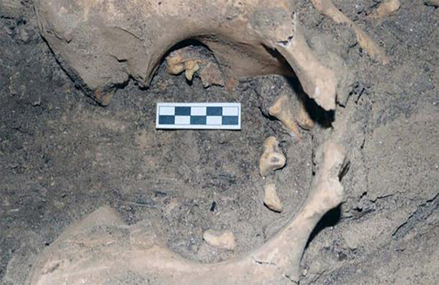 Unearthing an Ancient Medical Anomaly at Amarna