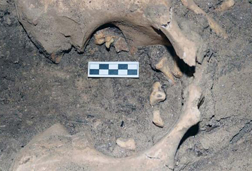 Unearthing an Ancient Medical Anomaly at Amarna